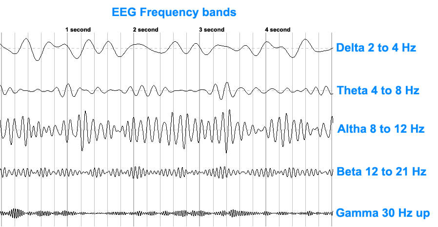 EEGFrequencybands